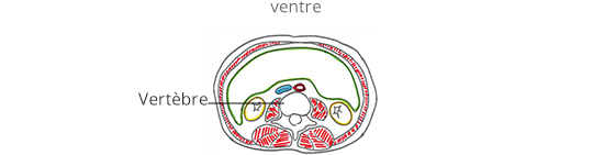 Arthrodese lombaire par voie anterieure mini invasive 01 Centre Du 
